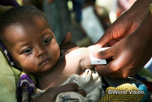 エチオピアの女の子が腕の太さを量って健康状態の検査を受けている
