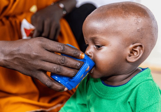 重度の栄養不良と診断され、栄養プログラムで命をつないだフアド君（ソマリア）